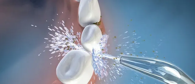 خيط الماء Waterpik FAOB
