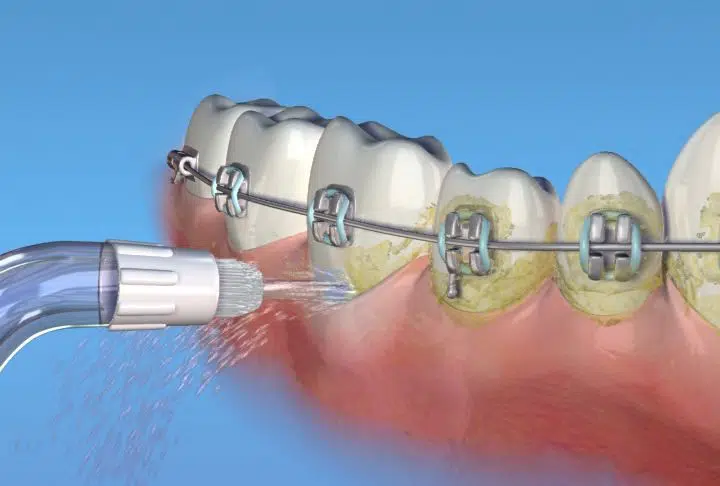 خيط الماء Waterpik FAOB